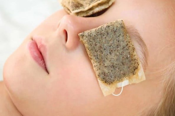 از کمپرس چای کیسه‌ای استفاده کنید